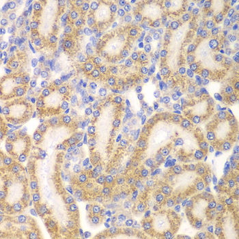 Immunohistochemistry - EYA3 Polyclonal Antibody 