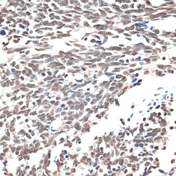 Immunohistochemistry - AQR Polyclonal Antibody 