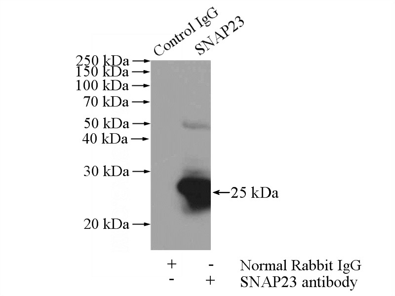 IP Result of anti-SNAP23 (IP:Catalog No:115444, 4ug; Detection:Catalog No:115444 1:500) with HeLa cells lysate 880ug.