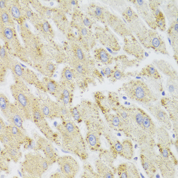 Immunohistochemistry - HSD17B13 Polyclonal Antibody 