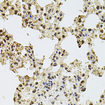 Immunohistochemistry - ZNF408 Polyclonal Antibody 
