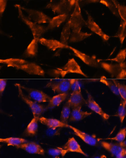 Immunofluorescence - FGA Polyclonal Antibody 