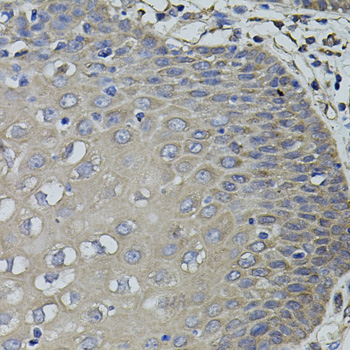 Immunohistochemistry - ACE Polyclonal Antibody 
