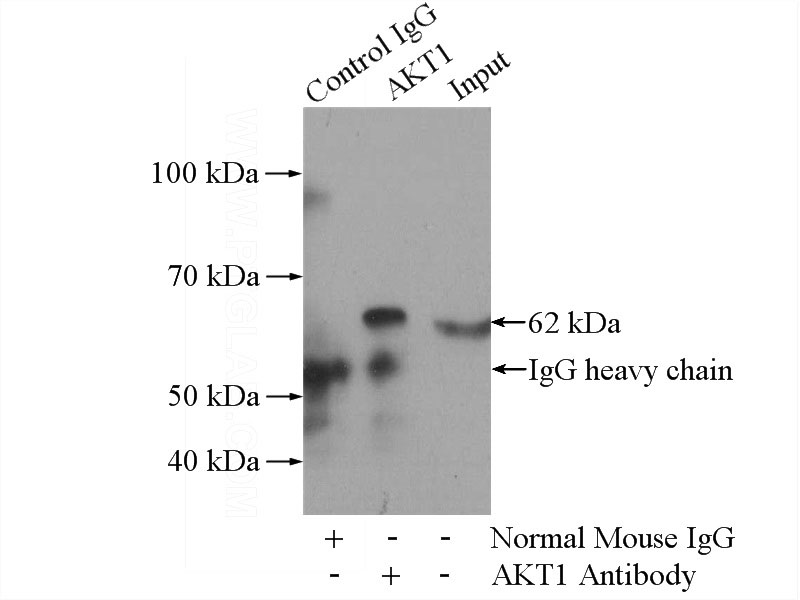 IP Result of anti-AKT (IP:Catalog No:107567, 5ug; Detection:Catalog No:107567 1:600) with mouse brain tissue lysate 3440ug.