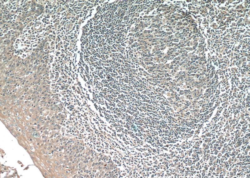 Immunohistochemistry of paraffin-embedded human tonsillitis tissue slide using Catalog No:107333(NINJ2 Antibody) at dilution of 1:50 (under 10x lens)