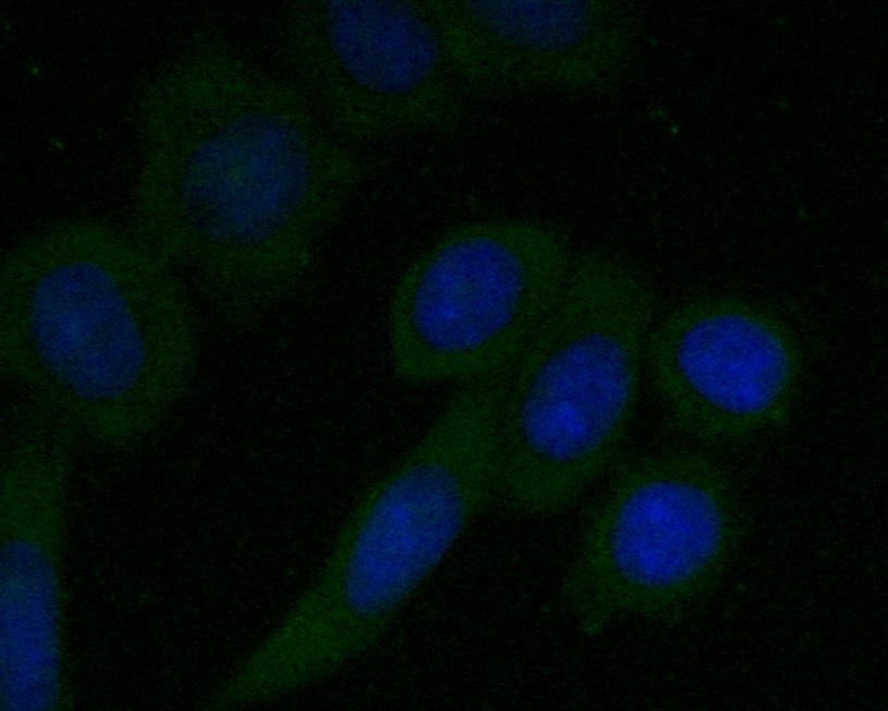 Fig2: ICC staining of CD68 in SiHa cells (green). Formalin fixed cells were permeabilized with 0.1% Triton X-100 in TBS for 10 minutes at room temperature and blocked with 1% Blocker BSA for 15 minutes at room temperature. Cells were probed with the primary antibody ( 1/50) for 1 hour at room temperature, washed with PBS. Alexa Fluor®488 Goat anti-Rabbit IgG was used as the secondary antibody at 1/1,000 dilution. The nuclear counter stain is DAPI (blue).