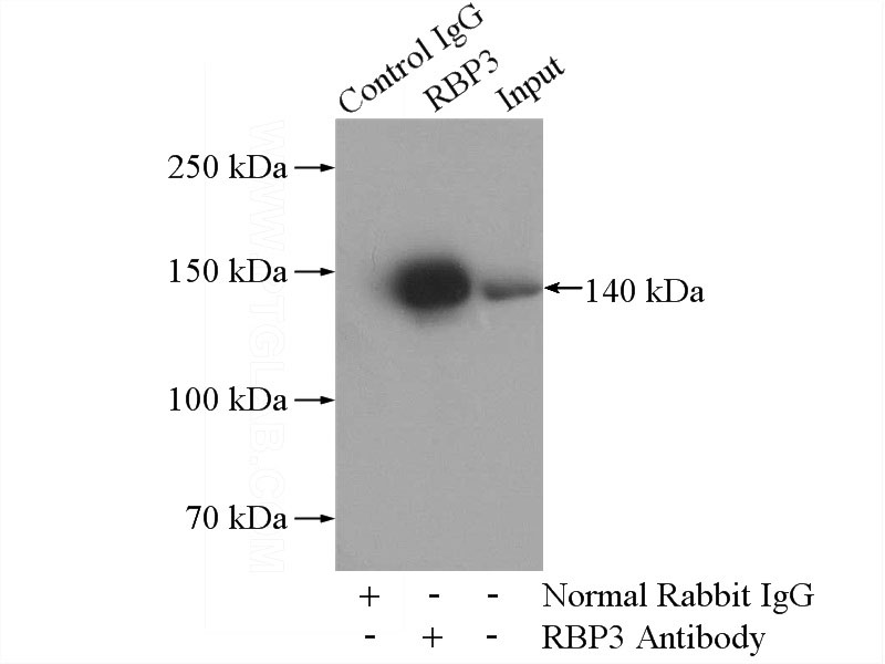 IP Result of anti-RBP3 (IP:Catalog No:114561, 4ug; Detection:Catalog No:114561 1:400) with Y79 cells lysate 2000ug.
