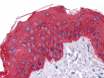 Immunohistochemical analysis of paraffin-embedded human Skin tissues using CK mouse mAb