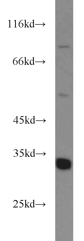 mouse liver tissue were subjected to SDS PAGE followed by western blot with Catalog No:110292(ECH1 antibody) at dilution of 1:500
