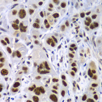 Immunohistochemistry - SF3B2 Polyclonal Antibody 