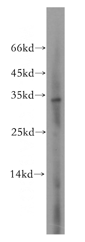 HEK-293 cells were subjected to SDS PAGE followed by western blot with Catalog No:113836(PITPNA antibody) at dilution of 1:800