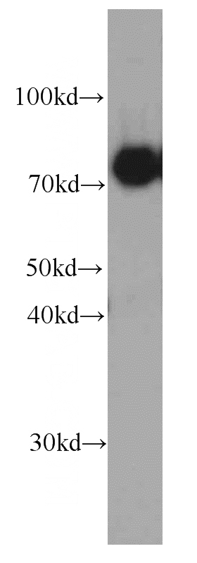 human brain tissue were subjected to SDS PAGE followed by western blot with Catalog No:107174(CPT1C antibody) at dilution of 1:500