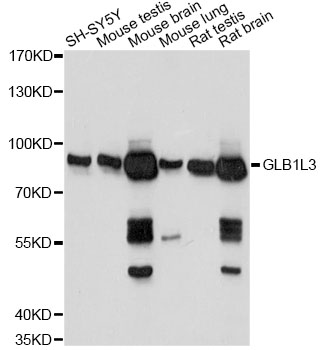 Western blot - GLB1L3 Polyclonal Antibody 