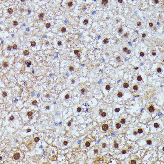 Immunohistochemistry - ID2 Polyclonal Antibody 