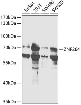 Western blot - ZNF264 Polyclonal Antibody 