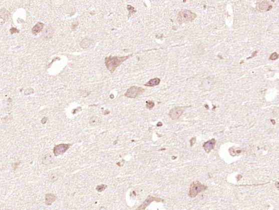 Fig1: Paraformaldehyde-fixed, paraffin embedded (mouse brain tissue); Antigen retrieval by boiling in sodium citrate buffer (pH6.0) for 15min; Block endogenous peroxidase by 3% hydrogen peroxide for 20 minutes; Blocking buffer (normal goat serum) at 37℃ for 30min; Antibody incubation with (BMPER) Polyclonal Antibody, Unconjugated at 1:400 overnight at 4℃, followed by operating according to SP Kit(Rabbit) (sp-0023) instructionsand DAB staining.