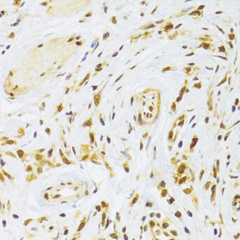 Immunohistochemistry - RPL13 Polyclonal Antibody 
