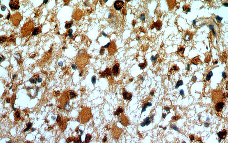 Immunohistochemical of paraffin-embedded human brain using Catalog No:115804(SYT17 antibody) at dilution of 1:50 (under 40x lens)