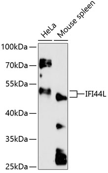 Western blot - IFI44L Polyclonal Antibody 