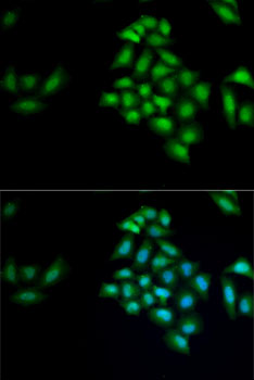 Immunofluorescence - KLK10 Polyclonal Antibody 