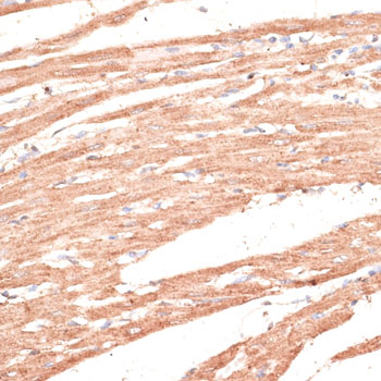 Immunohistochemistry - KIF1C Polyclonal Antibody 
