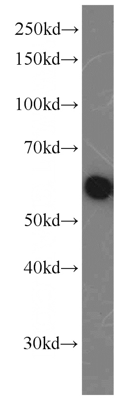 A431 cells were subjected to SDS PAGE followed by western blot with Catalog No:110763(G3BP1 antibody) at dilution of 1:1000