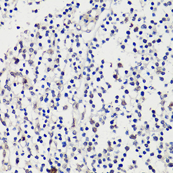 Immunohistochemistry - WT1 Polyclonal Antibody 