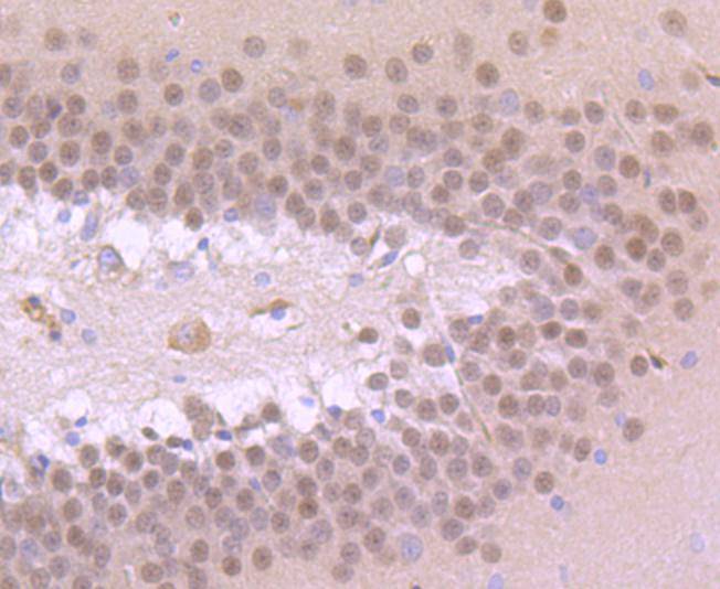 Fig2:; Immunohistochemical analysis of paraffin-embedded rat brain tissue using anti-TBR1 antibody. The section was pre-treated using heat mediated antigen retrieval with Tris-EDTA buffer (pH 8.0-8.4) for 20 minutes.The tissues were blocked in 5% BSA for 30 minutes at room temperature, washed with ddH; 2; O and PBS, and then probed with the primary antibody ( 1/50) for 30 minutes at room temperature. The detection was performed using an HRP conjugated compact polymer system. DAB was used as the chromogen. Tissues were counterstained with hematoxylin and mounted with DPX.