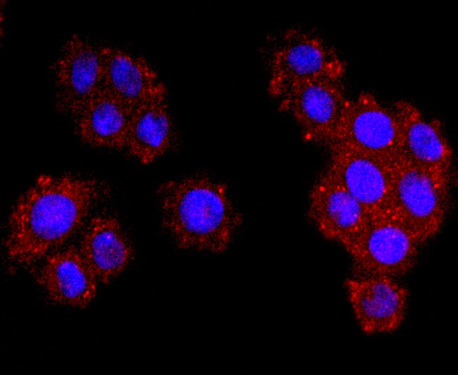 Fig2:; ICC staining of Dysferlin in SW480 cells (red). Formalin fixed cells were permeabilized with 0.1% Triton X-100 in TBS for 10 minutes at room temperature and blocked with 1% Blocker BSA for 15 minutes at room temperature. Cells were probed with the primary antibody ( 1/50) for 1 hour at room temperature, washed with PBS. Alexa Fluor®594 Goat anti-Rabbit IgG was used as the secondary antibody at 1/1,000 dilution. The nuclear counter stain is DAPI (blue).