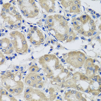 Immunohistochemistry - ST8SIA2 Polyclonal Antibody 