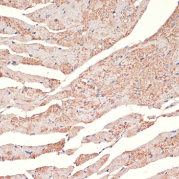 Immunohistochemistry - ADRA1A Polyclonal Antibody 