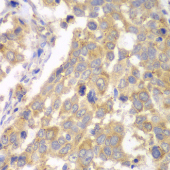 Immunohistochemistry - PFKM Polyclonal Antibody 