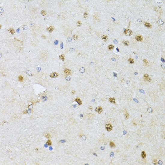 Immunohistochemistry - CMAS Polyclonal Antibody 