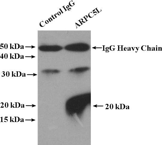 IP Result of anti-ARPC5L (IP:Catalog No:108169, 4ug; Detection:Catalog No:108169 1:1000) with mouse brain tissue lysate 4000ug.