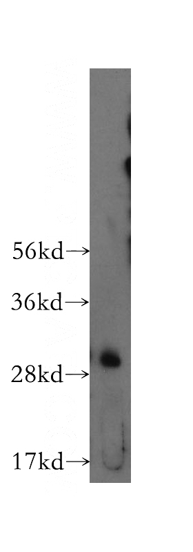 human kidney tissue were subjected to SDS PAGE followed by western blot with Catalog No:109721(CTDSP2 antibody) at dilution of 1:400