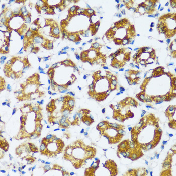 Immunohistochemistry - APOBEC3F Polyclonal Antibody 