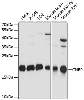 Western blot - CNBP Polyclonal Antibody 