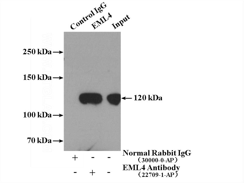 IP Result of anti-EML4 (IP:Catalog No:110243, 4ug; Detection:Catalog No:110243 1:2000) with A549 cells lysate 400ug.