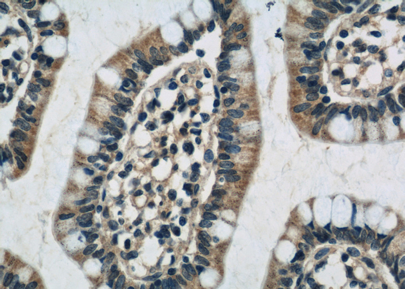 Immunohistochemistry of paraffin-embedded human small intestine slide using Catalog No:114918(RQCD1 Antibody) at dilution of 1:50