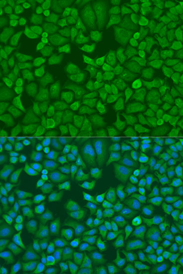 Immunofluorescence - IGF2BP1 Polyclonal Antibody 