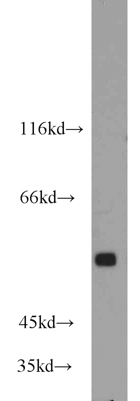 mouse brain tissue were subjected to SDS PAGE followed by western blot with Catalog No:111127(GPR37 antibody) at dilution of 1:1600