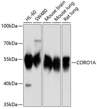 Western blot - CORO1A Polyclonal Antibody 