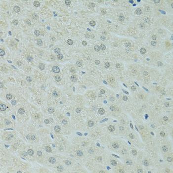 Immunohistochemistry - RCC1 Polyclonal Antibody 