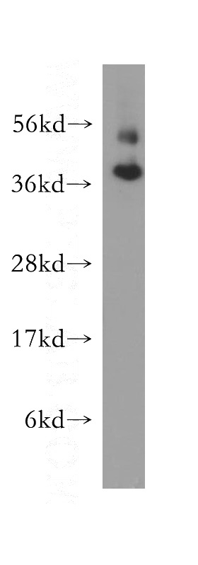 human brain tissue were subjected to SDS PAGE followed by western blot with Catalog No:110468(FAM127A antibody) at dilution of 1:300