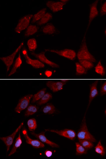 Immunofluorescence - APBB1 Polyclonal Antibody 