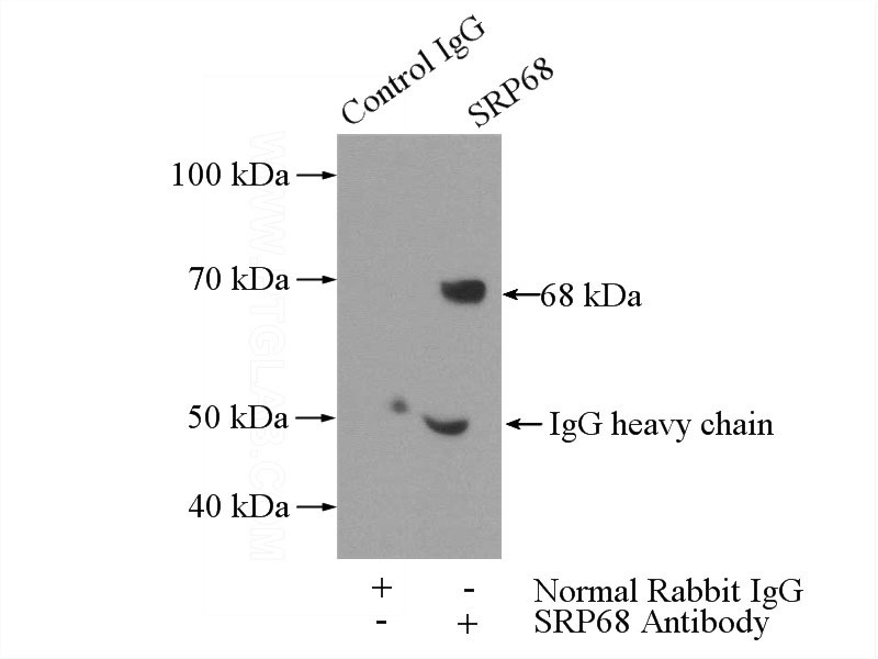 IP Result of anti-SRP68 (IP:Catalog No:115594, 4ug; Detection:Catalog No:115594 1:400) with mouse kidney tissue lysate 4000ug.