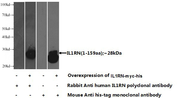 Transfected HEK-293 cells were subjected to SDS PAGE followed by western blot with Catalog No:111772(IL1RN Antibody) at dilution of 1:500