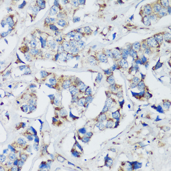 Immunohistochemistry - ELP3 Polyclonal Antibody 