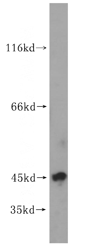 human testis tissue were subjected to SDS PAGE followed by western blot with Catalog No:116540(UBE2Z antibody) at dilution of 1:300