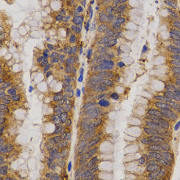 Immunohistochemistry - MMP25 Polyclonal Antibody 